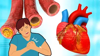 40 Foods to Clean Your Arteries to Prevent a Heart Attack | Dr. Mandell