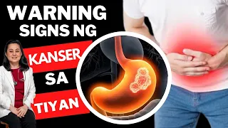 Early Warning Signs ng Kanser sa Tiyan - By Doc Liza Ramoso-Ong