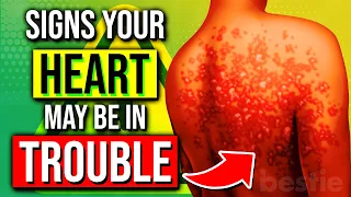 Don't Ignore The 4 WARNING Signs Your HEART May Be In TROUBLE!