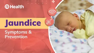 Jaundice: Symptoms, Prevention and Everything You Need to Know