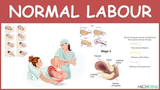 Physiology of Normal Labour, stages, mechanisms and management