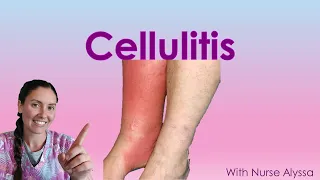 Cellulitis