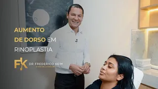 Aumento de Dorso em Rinoplastia | Frederico Keim