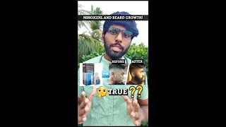 Does Minoxidil Work for Beard? | Beard Growth tips in tamil #shorts