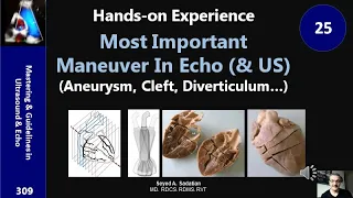 Hands-on Experience 25: Most Important Maneuver In Echo (& US)(Aneurysm, Cleft, Diverticulum…)