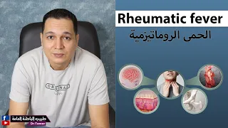 الحمى الروماتيزمية / Rheumatic fever