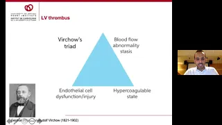 Left Ventricle Thrombus