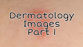 Dermatology Images | Images Based Q Derma | Histology Slides | INI-CET Exam Part - 1 || Mis.Medicine