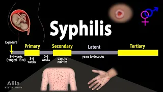 Syphilis - Pathophysiology, Diagnosis and Treatments, Animation