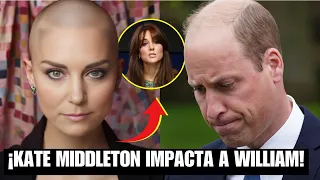 Kate Middleton se le CAE el CABELLO y RECHΑZA USAR PELUCA, TRISTE ÚLTIMA HORA de William