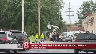 Person suffers severe electrical burns in accident at North Haven business