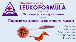 Паразиты крови и костного мозга. Трейлер. Экспертная микроскопия.