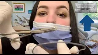 [ASMR] Applying Your Braces