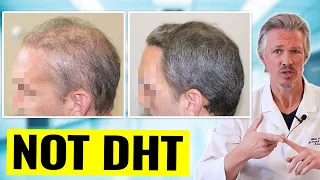 INFLAMMATORY HAIR LOSS 90 DAY RESULTS! SEE WHAT CAN HAPPEN WHEN YOU TREAT THE CAUSE CORRECTLY