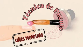 Técnica de Puente, para uñas mordidas.