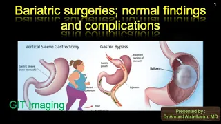 21-Bariatric surgery