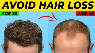 Topical Finasteride For Hair Loss: What YOU Need To Know