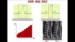 TIPS AND TRICKS TO  PERFECT MRI IMAGING