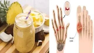 Say Goodbye to Gout Forever With This Powerful Natural Treatment!