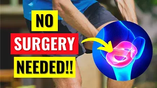 Why You Don't Need Surgery For Your Meniscus Tear