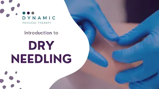 What Is Dry Needling?