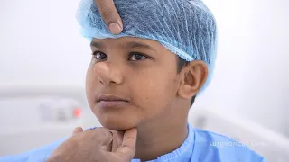 Pinocchio Nose Boy Rare Cyst Removal Surgery