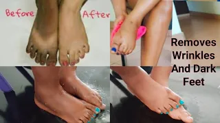 APPLY OVERNIGHT TO SOFTEN AND BRIGHTEN DARK FEET REMOVE WRINKLES FROM  FEET