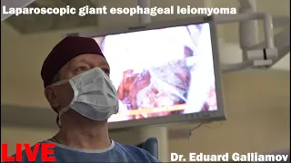 Giant esophageal GIST, LIVE  / Лейомиома пищевода