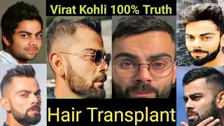 Virat Kohli Hair Transplant Results | Celebrity Hair Transplant Results | Cricketer Hair Transplant