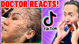 Plastic Surgeon Reacts to OUTRAGEOUS TikTok Videos!