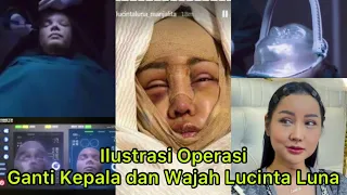 VIRAL - Ilustrasi Operasi Ganti Kepala dan Wajah Lucinta Luna