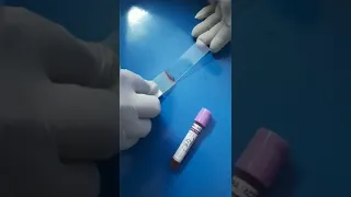 malaria slide preparation ! MP Blood smear ! thick and thin smear for malaria parasites