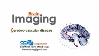 Imaging of Cerebrovascular stroke - Prof. Mamdouh Mahfouz