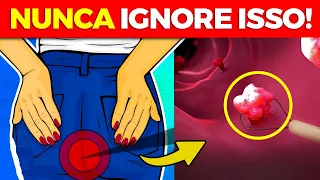 10 SINTOMAS de ALERTA do CÂNCER DE INTESTINO que você NUNCA DEVE IGNORAR!