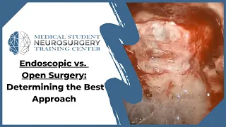 Endoscopic vs. Open Surgery: Determining the Best Approach