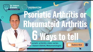 Six Ways Doctors Can Tell If This Is Rheumatoid Arthritis Or Psoriatic Arthritis!