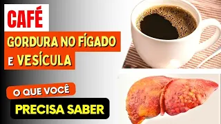 CAFÉ, GORDURA NO FÍGADO e CÁLCULOS BILIARES -  O que você PRECISA SABER!