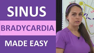 Sinus Bradycardia ECG/EKG Interpretation, Causes, Treatment, Nursing NCLEX Review Cardiac