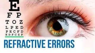 Refractive errors || Myopia || Astigmatism
