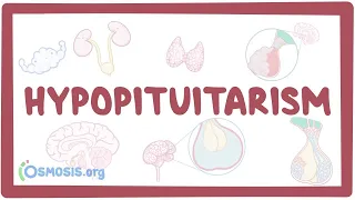 Hypopituitarism - causes, symptoms, diagnosis, treatment, pathology