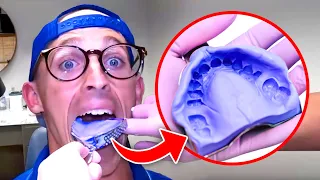 Is THIS the Most Enjoyable Part of Getting Braces? Impressions 101
