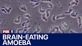 What is a brain-eating amoeba? | FOX 5 News