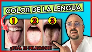 ¿Qué SIGNIFICA el COLOR de tu LENGUA? || ¿Cuál INDICA enfermedad GRAVE?