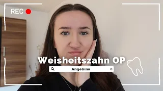 Weisheitszahn OP - Ich bekomme alle 4 Zähne gezogen... | Angeliina