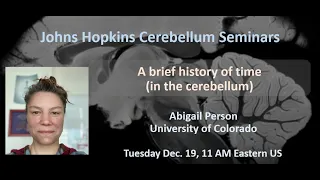 Abigail Person: A brief history of time (in the cerebellum)