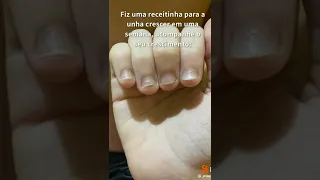 Processo de crescimento da minha unha | #shorts #youtubeshorts #aninha #viral #unhas