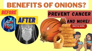 What Happens If We Eat Onion Daily