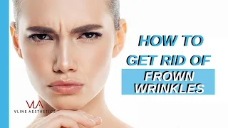 Treating Frown Lines with Botox A and PDO Threads | Skin Perfect Walnut Medical Spa Clinic