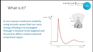 Focal Extracorporeal Shockwave therapy (ESWT) in Sports – Innovation at Aspetar - Dr Aston Ngai