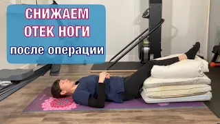 КАК СНИЗИТЬ ОТЕК НОГИ ПОСЛЕ операции ? How to reduce SWELLING after surgery (English subt).